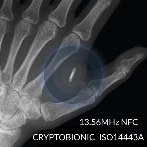 nfc implant credit card|rfid chip implants.